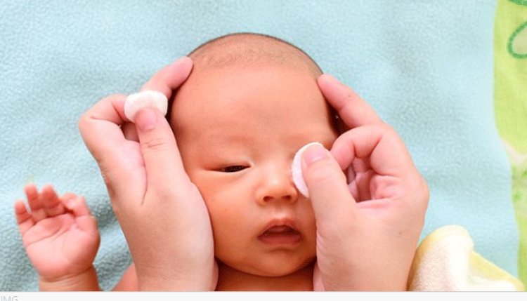 5. Home Remedies of Treating Eye Discharge in Toddlers