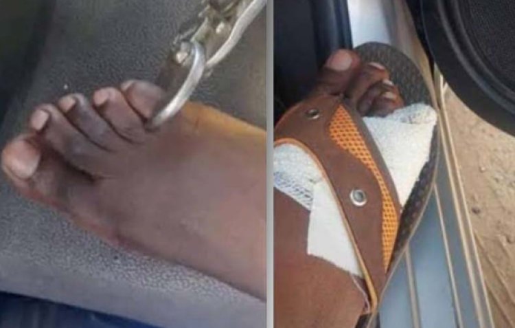 Man Charged For Joking About Buying Human Toes, Zimbabwe